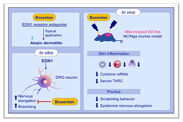 atopic dermatitis