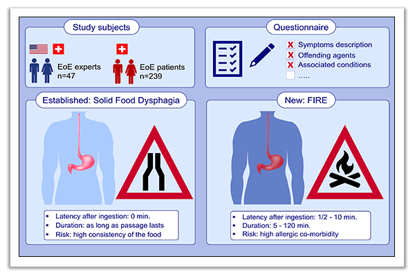 food-induced immediate response of the esophagus