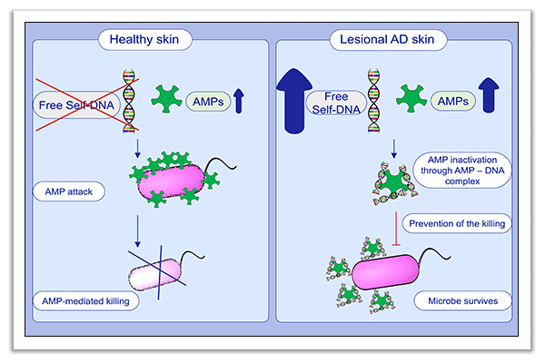 antimicrobial peptides in atopic dermatitis