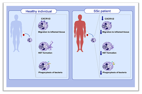 innate immunity