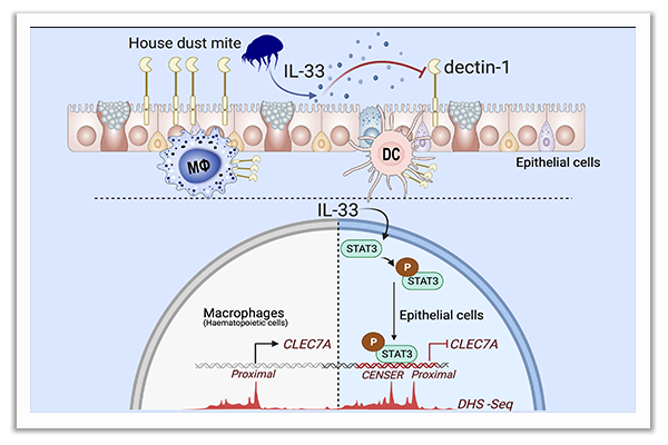 allergic diseases